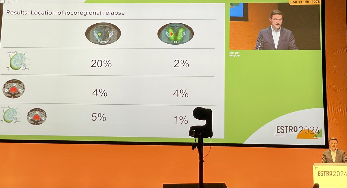#ESTRO24 @piet_ost presenting outcomes of STORM randomized Ph II of MDT v ENRT for oligorecurrent prostate cancer #pcsm ✅ ENRT ⬆️BRFS, LRFS MDT a/w 8-fold ⬆️ nodal recurrence 3➡️25% Omitting PB ⬆️ local recurrences 3-fold (5➡️14%), but also increases GU2+ toxicity