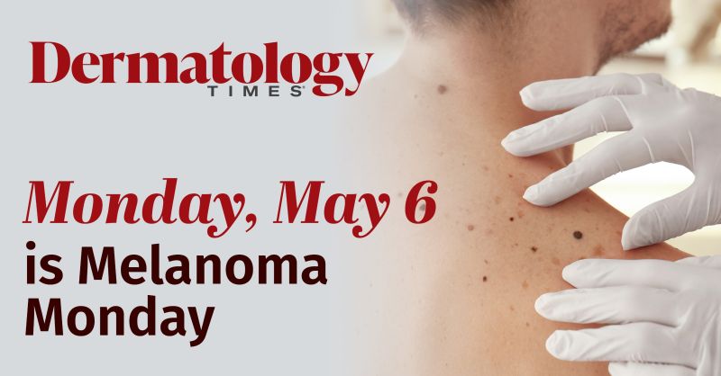 Today is #MelanomaMonday. The American Academy of Dermatology began Melanoma Monday in 1995, and it has been observed on the first Monday in May ever since.