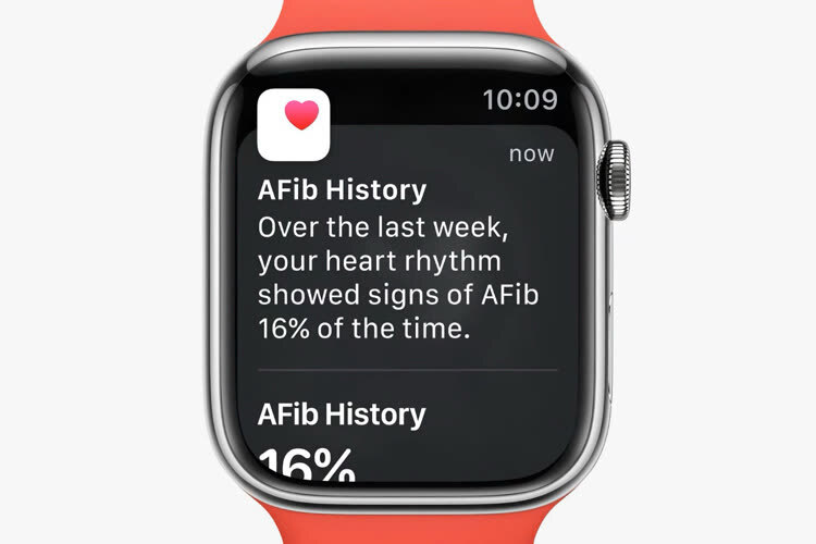 L'Apple Watch gagne une certification médicale pour la fibrillation atriale watchgeneration.fr/apple-watch/20…