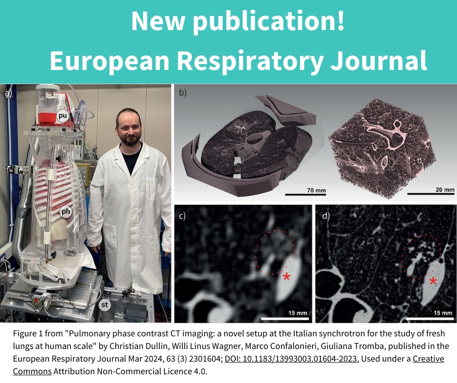 🆕Game changer! Giuliana Tromba @elettrasincro, #EuroBioImaging Scientific Ambassador Christian Dullin & their teams have achieved high-res tomography w/7x better details & 2-3x less exposure than traditional CT. They explain how in a recent paper. More⤵️ eurobioimaging.eu/news/pushing-t…