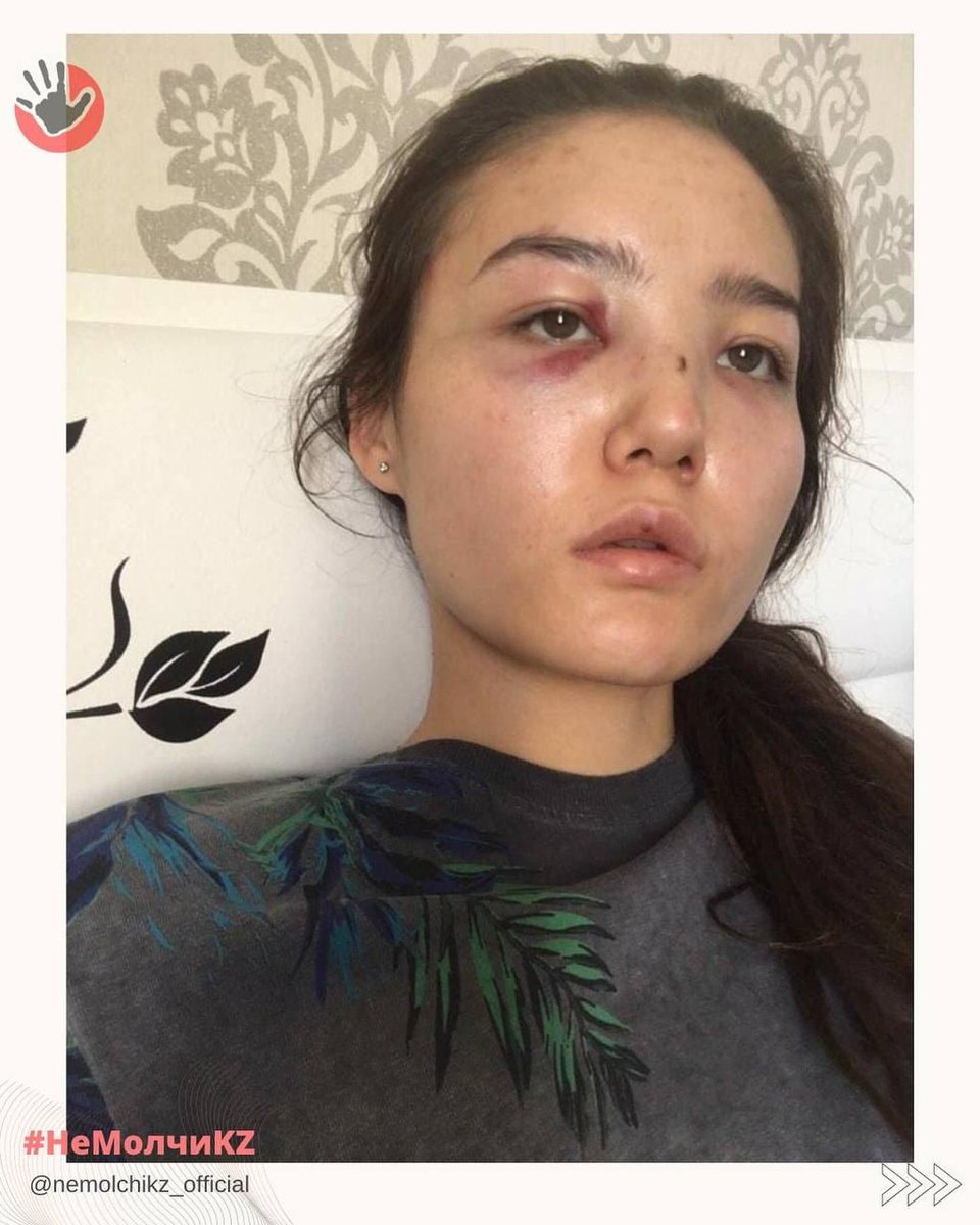 GeorgShilin's tweet photo. Жена советника посольства Казахстана в ОАЭ рассказала о насилии со стороны мужа на протяжении 10 лет
Супруга Сакена Мамаша, Карина, записала видеообращение и показала фотографии побоев разных лет.
В МИДе Казахстана заявили, что Сакена Мамаша отозвали из посольства — он будет уволен. Его делом занимаются правоохранительные органы.