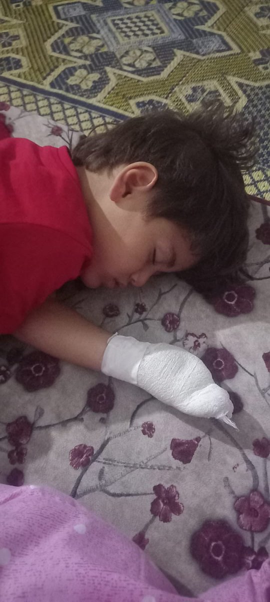 My nephew, Omer, has been injured for the third time, lost his dad, grandpa, and four cousins so far, and is currently displaced. Could I know what Omer has done to deserve this? Omer’s Dad is still under the rubble 💔
