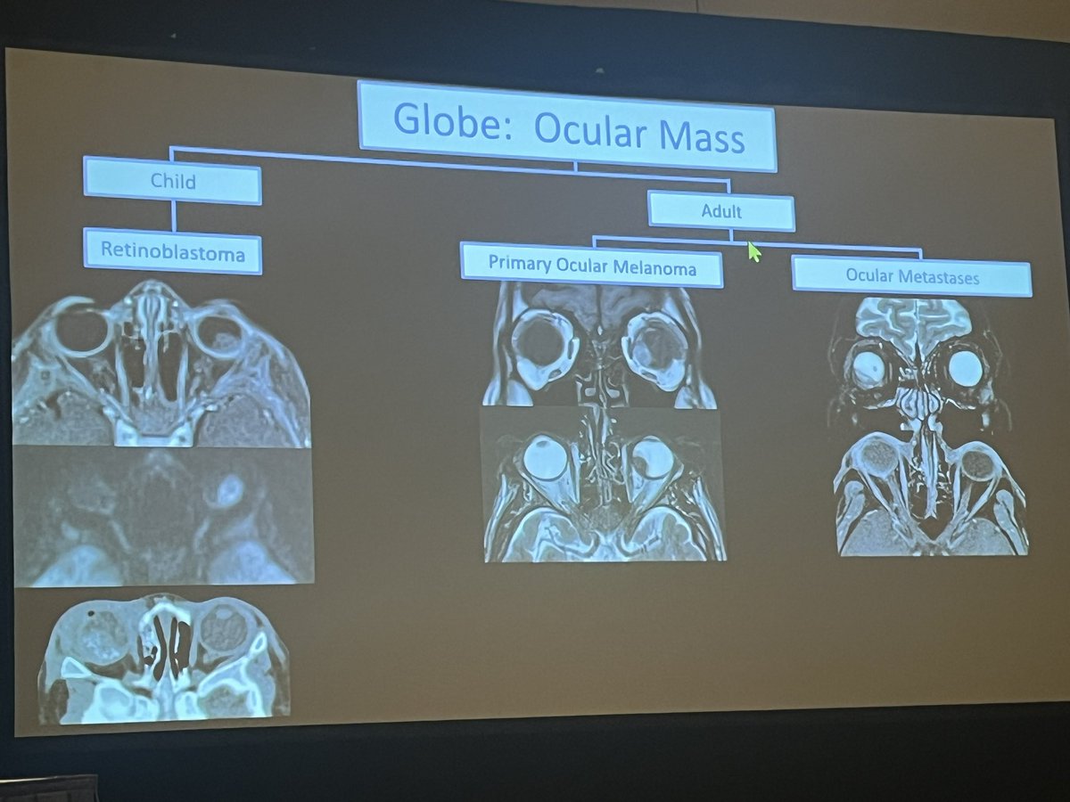 Dr. Mari Hagiwara describes orbital tumors at #ARRS24