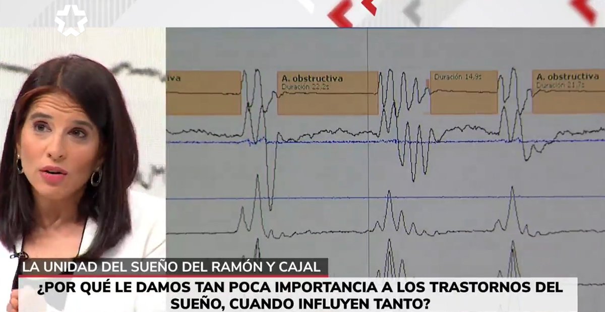 Irene Cano (@cano_pumarega) on Twitter photo Gracias a <a href="/telemadrid/">Telemadrid</a> por haber acercado al plató de <a href="/BuenosDiasTM/">Buenos Días Madrid</a> la Unidad de Sueño y Epilepsia del #HospitalRamónyCajal para enseñar como trabajamos allí y hablar de la importancia del sueño.
<a href="/HrcServicio/">Servicio Neumología HRyC</a> <a href="/Sociedad_SES/">SES</a> <a href="/SeparRespira/">SeparRespira</a>
Ver🎞️Min 6.42´´👇
telemadrid.es/programas/buen… Gracias a <a href="/telemadrid/">Telemadrid</a> por haber acercado al plató de <a href="/BuenosDiasTM/">Buenos Días Madrid</a> la Unidad de Sueño y Epilepsia del #HospitalRamónyCajal para enseñar como trabajamos allí y hablar de la importancia del sueño.
<a href="/HrcServicio/">Servicio Neumología HRyC</a> <a href="/Sociedad_SES/">SES</a> <a href="/SeparRespira/">SeparRespira</a>
Ver🎞️Min 6.42´´👇
telemadrid.es/programas/buen…