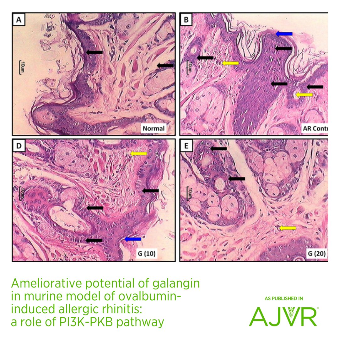 #Galangin exhibited antihistaminic and anti-inflammatory effects in allergic rhinitis mice by regulating IgE-mediated histamine and inflammatory release: jav.ma/Galangin #PI3K #interleukins #ovalbumin #allergicrhinitis