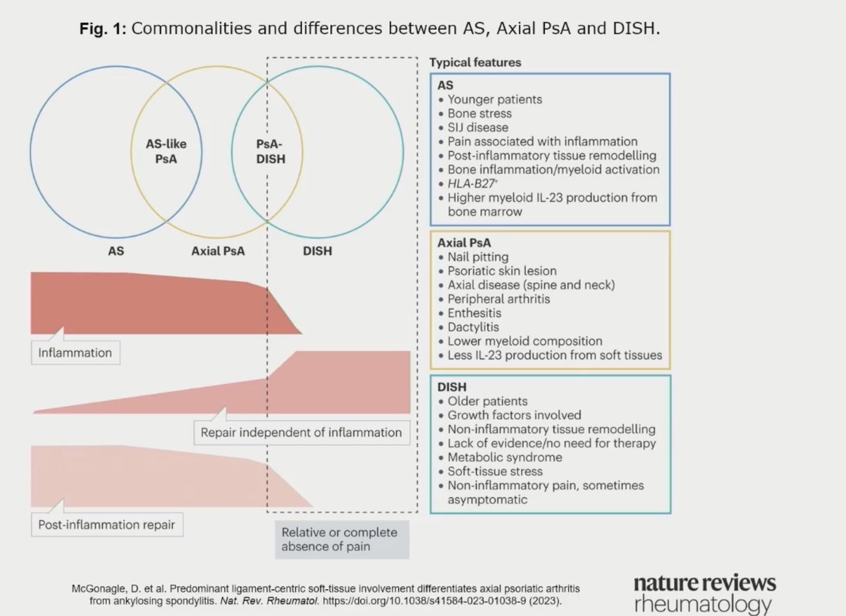 #AxialSpA vs #AxialPsA vs DISH You can categorise the pure AS Phenotype (PT), The Mixed Overlapping AS PT & The True Axial PsA PT which then merges into DISH and True DISH👇 #BSR24 (Prof D McGonagle) #Rheumatology