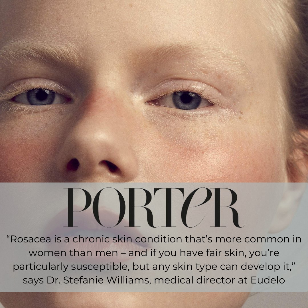 Dr. Stefanie Williams, whose expertise shines through in her recent feature on Rosacea in Porter Online. With grace and precision,
#dermatologist #dermatology #skinhealth #bestdermatologistlondon #acne #rosacea  #chelsea #sloanesquare #sloaneavenue #aesthetics