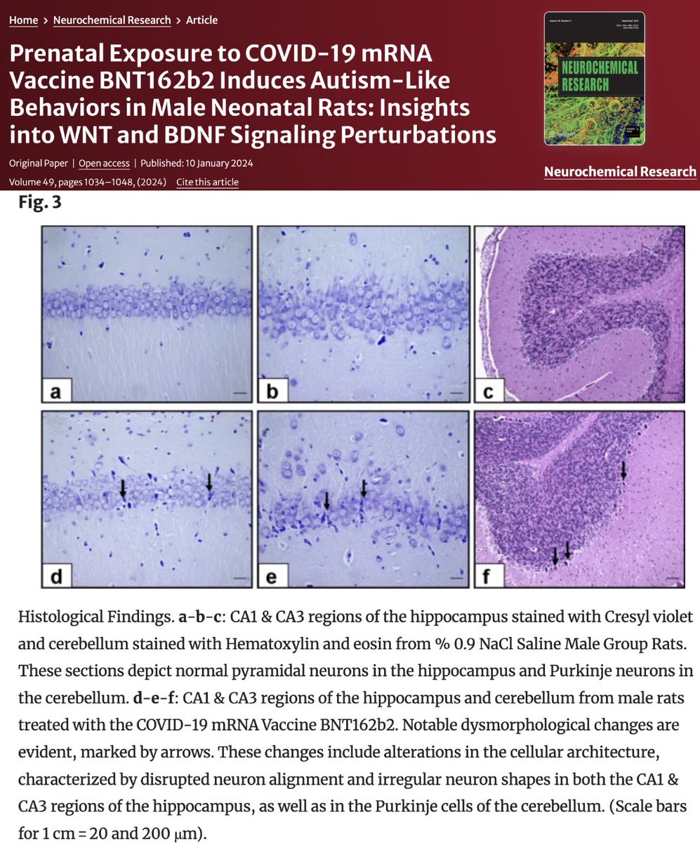 STUDY - @pfizer mRNA COVID-19 injections cause brain damage in the offspring of pregnant rats, resulting in pronounced autism-like behavior after birth. WNT gene expression and BDNF levels were deleteriously altered and neuronal counts were substantially decreased in critical