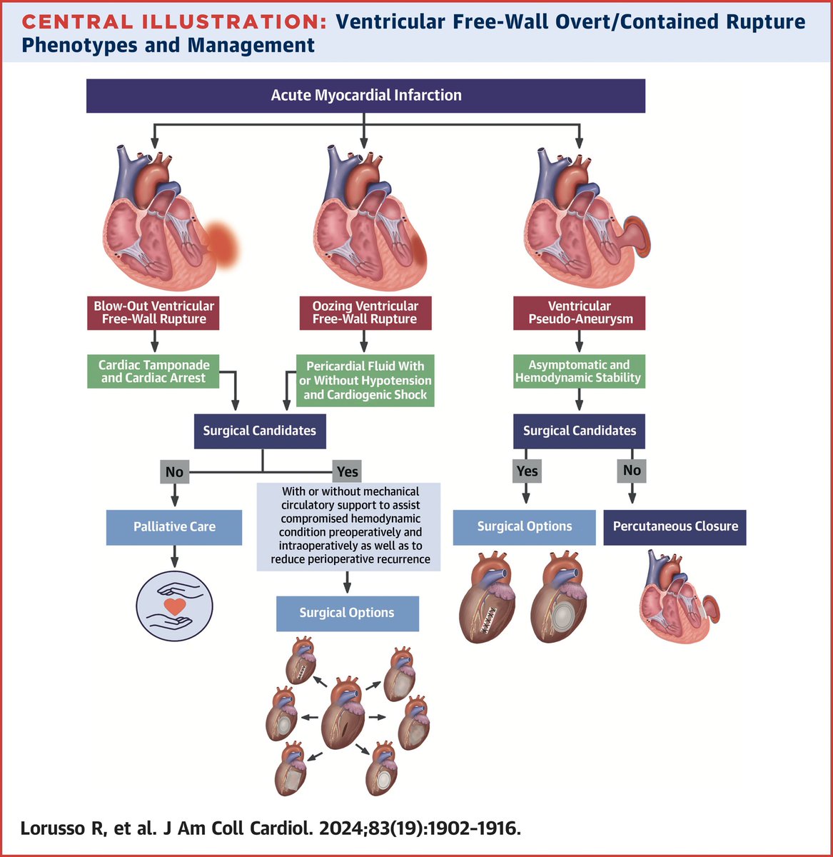 📌Ventricular #Pseudoaneurysm & Free Wall Rupture After Acute Myocardial Infarction @JACCJournals #FocusSeminar #AMIComplications #RadialFirst #Review