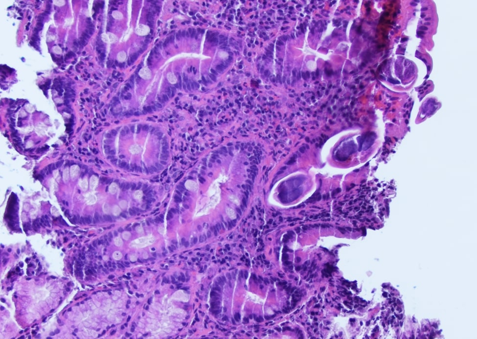 NYUGSOM Pathology Residency tweet media