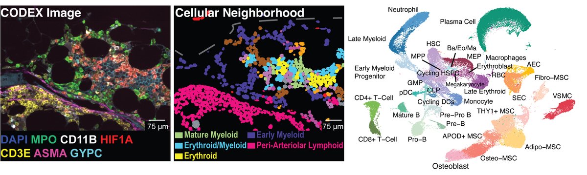 Excited to share the first spatially resolved multiomics atlas for human bone marrow, published today in @CellCellPress. twtr.to/cJ099. Wonderful collaborations with Ling Qin @LingQin6, Charles Nelson, Martin Carroll, Ivan Maillard, Vinohd Pillai @pillai_vinodh labs!