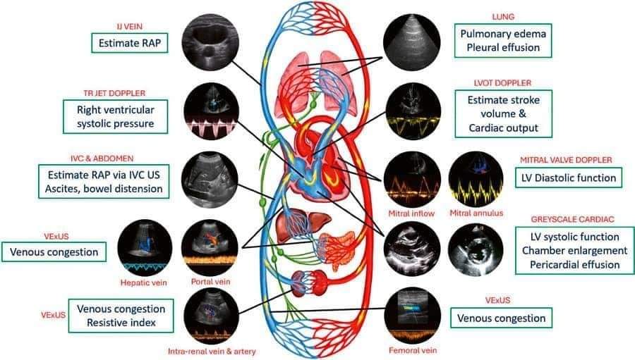 🔴 Bedside Ultrasound in the Management of Cardiorenal Syndromes: An Updated Review
#openaccess 

karger.com/crm/article/13…
#Cardiology #medEd #medical #medtwitter #CardioEd #CardioTwitter #cardiology #meded #medtwitter #CardioEd #CVD