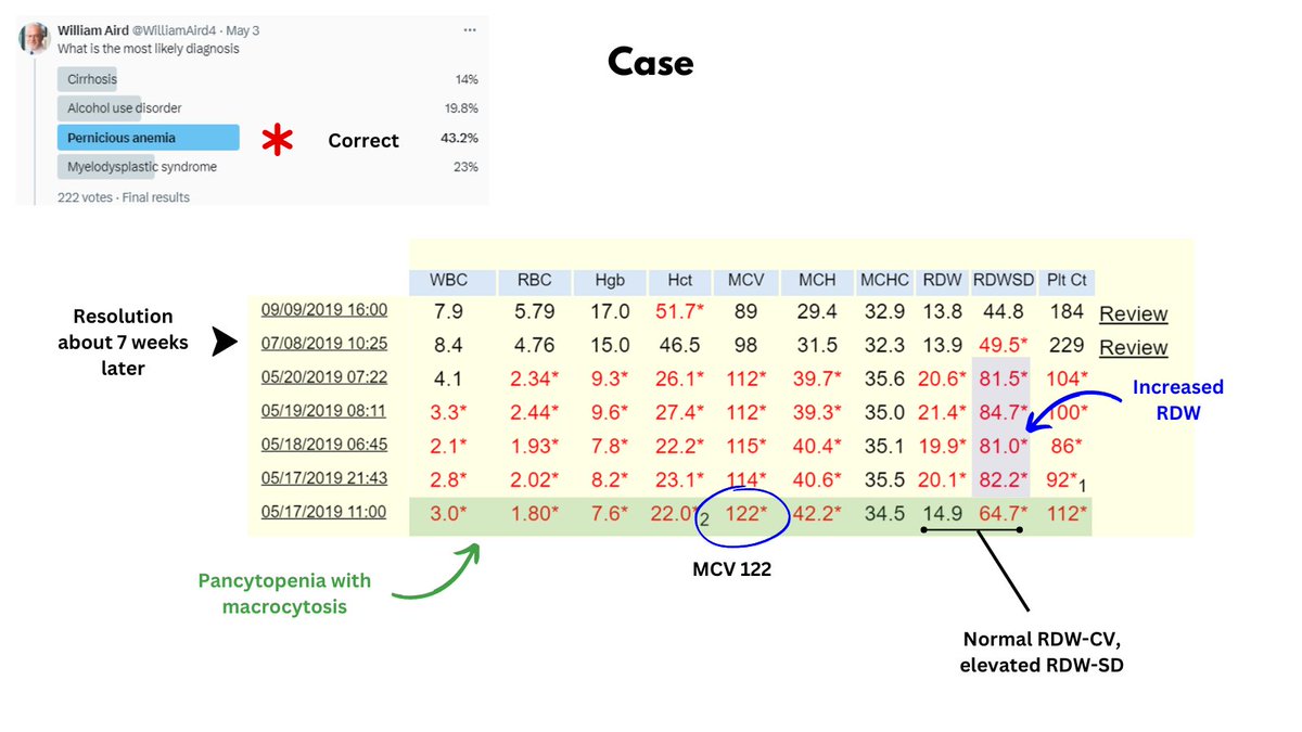 1/5

PERNICIOUS ANEMIA

I posted a poll asking whether the CBC time series shown in the graphic is from a patient with cirrhosis, alcohol use disorder, pernicious anemia (PA) or MDS.

The answer was PA.