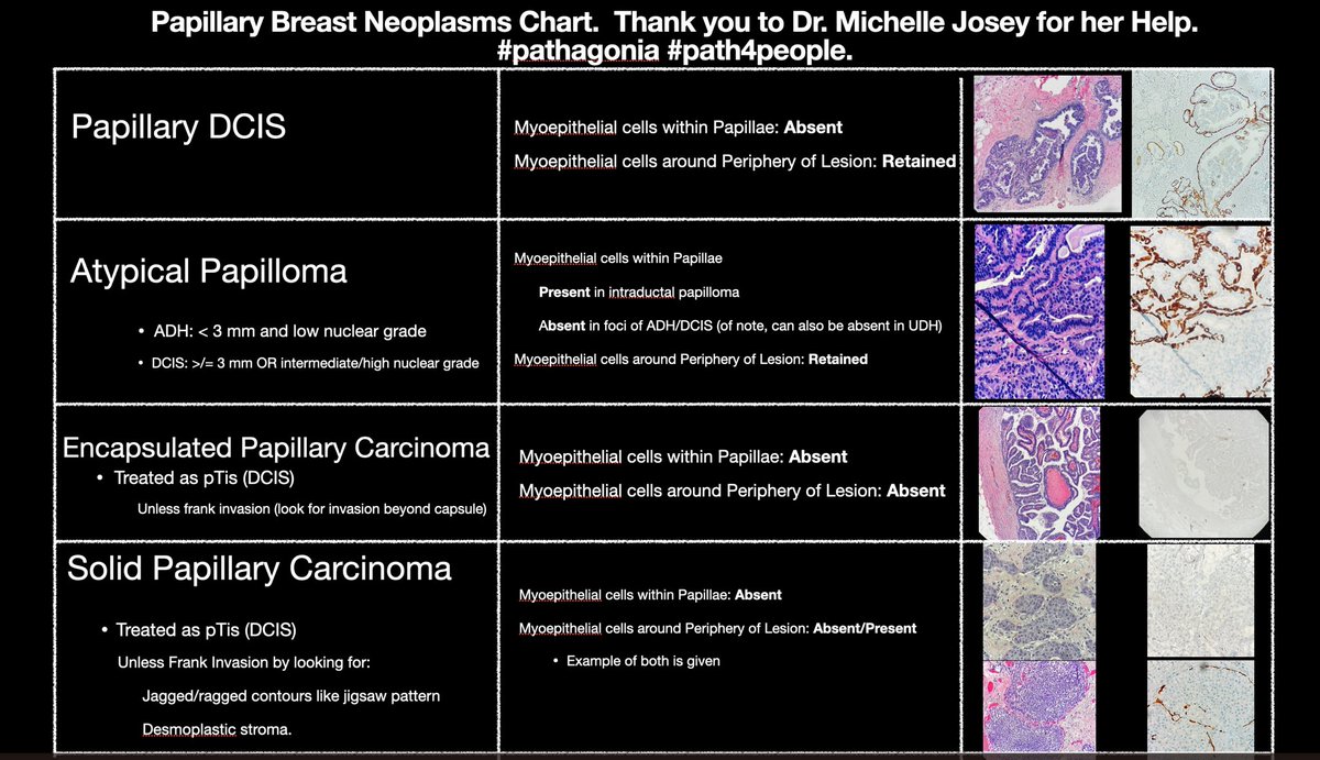 #pathagonia made a chart on papillary lesions of the breast. 

We hope it may be of help/quick reference 🙏🏼🤓

#pathx #pathtwitter #path4people #pathology #surgpath #breastpath #gynpath