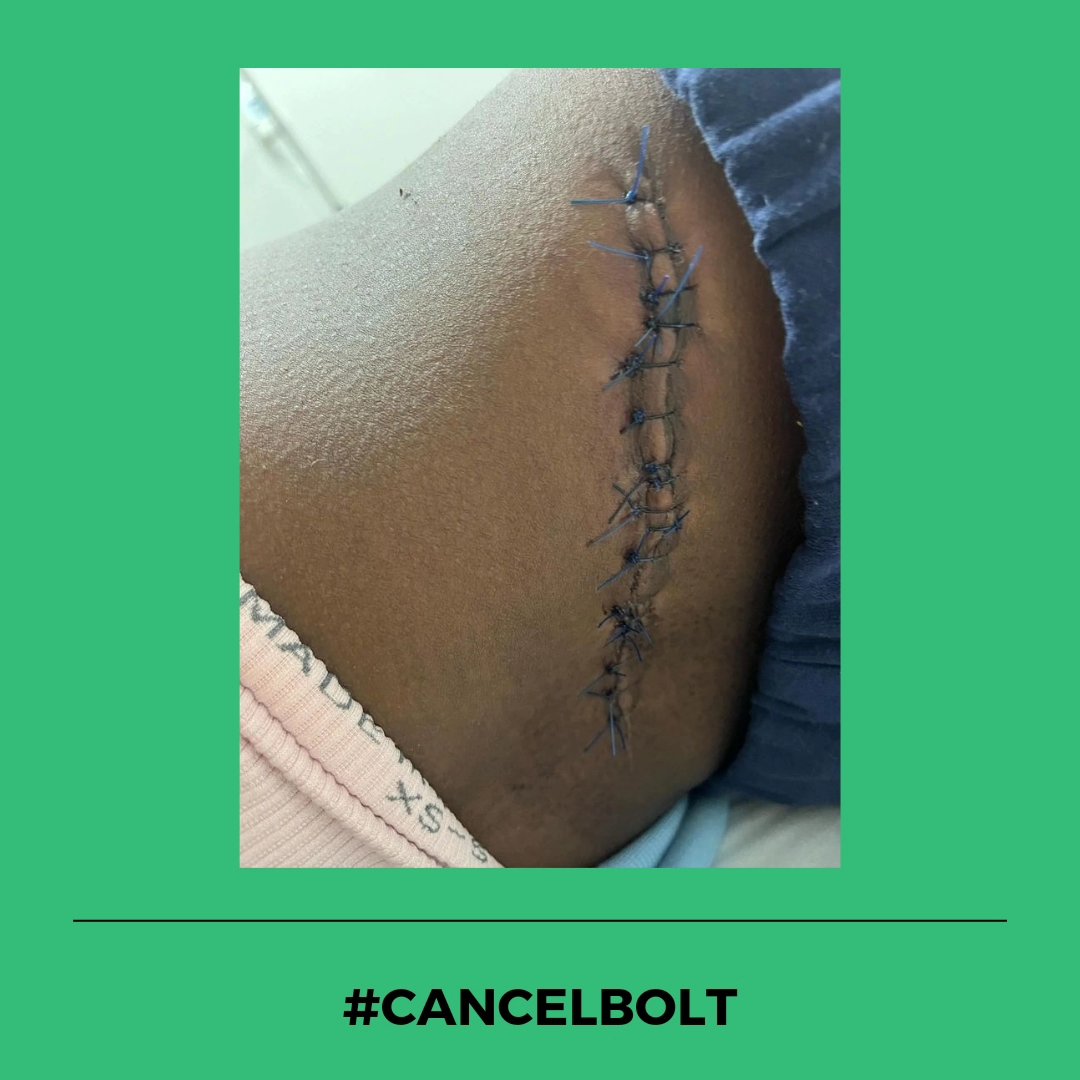 womenforchange5's tweet photo. Bolt must take action. #cancelbolt https://t.co/9BQrgjalhc
