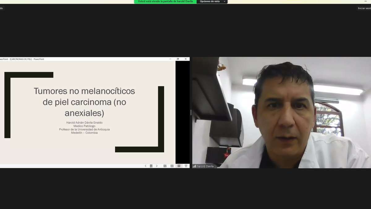 En Programa Anatomía Patológica, de @ProjectECHO El Salvador, se habló de, tumores no melanocíticos: carcinomas epidérmicos no anexiales, con la participación del Dr. Harol Adrián Dávila, patólogo de la Universidad de Medellín, Colombia.