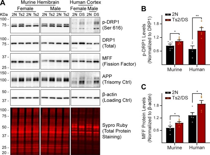 Ts2 #mitovesicles perturb long-term potentiation (LTP) of otherwise normal hippocampi, while microvesicles and exosomes isolated from the same brains and mitovesicles isolated from control brains do not impair LTP.

…arneurodegeneration.biomedcentral.com/articles/10.11…