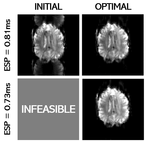 Looking forward to presenting my work on sequence optimization using a digital twin of an MR scanner! Please come to the Ultra-Challenging Ultra-High Field session at 13:30 this afternoon to find out more! #ISMRM24 #ISMRM2024