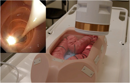 In iNNOVATIONS in iGIE, Landewee et al describe a “Magnetic flexible endoscope: a novel platform for diagnostic and therapeutic colonoscopy.” igiejournal.org/article/S2949-… @KeithObstein @MetabolicEndo @gutdoc18