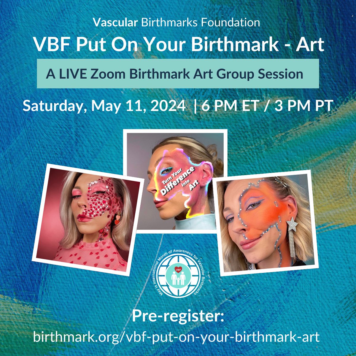 Register for VBF's Put On Your Birthmark - Art, a special collaborative LIVE Zoom event happening on Saturday, May 11, 2024, at 6 PM ET / 3 PM PT: birthmark.org/vbf-put-on-you…