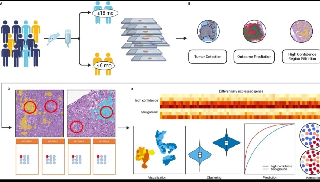 Laury et al. interrogated the molecular features of high grade serous carcinoma tissue regions identified as being highly associated with patient outcome by a deep-learning based AI classification model. ➡ modernpathology.org/article/S0893-…

#singlecell #spatialomics #spatialbiology