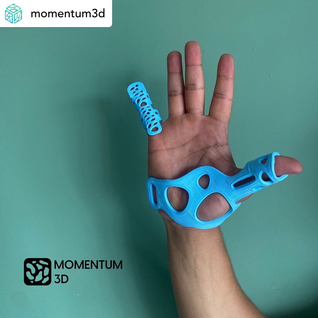3dheals's tweet photo. #repost @momentum3d Una férula en 3D? Pues estos son algunos de nuestros productos son diseños innovadores pensados en las condiciones de cada persona. #ferulas3d #fisioterapiacalisur #médicoscali #cali #ortesiscali #momentum3d https://t.co/B6AJfK6yPe