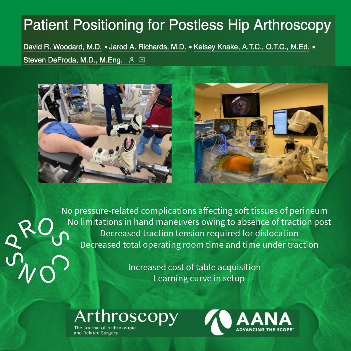 Check out this article describing patient positioning for postless hip arthroscopy! #HipArthroscopy @DeFrodaSportsMD ow.ly/4Bak50RrtQk