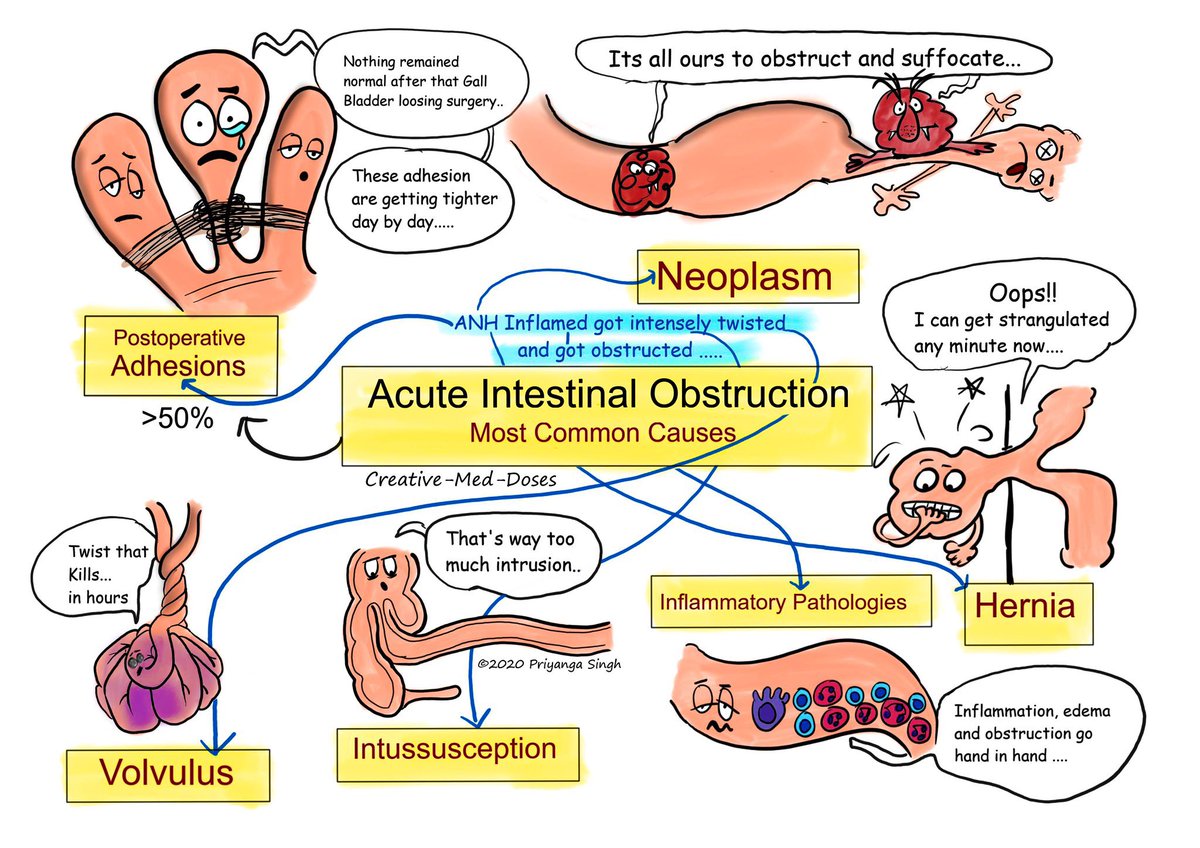 CAUSAS DE OBSTRUCCIÓN INTESTINAL 🙋🏻‍♂️

 #SoMe4PedSurg