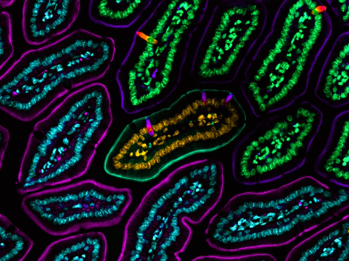 The intestine has the coolest cells...

#TuftTuesday #intestine #bioart #sciart #pathart #histoart #microscopy