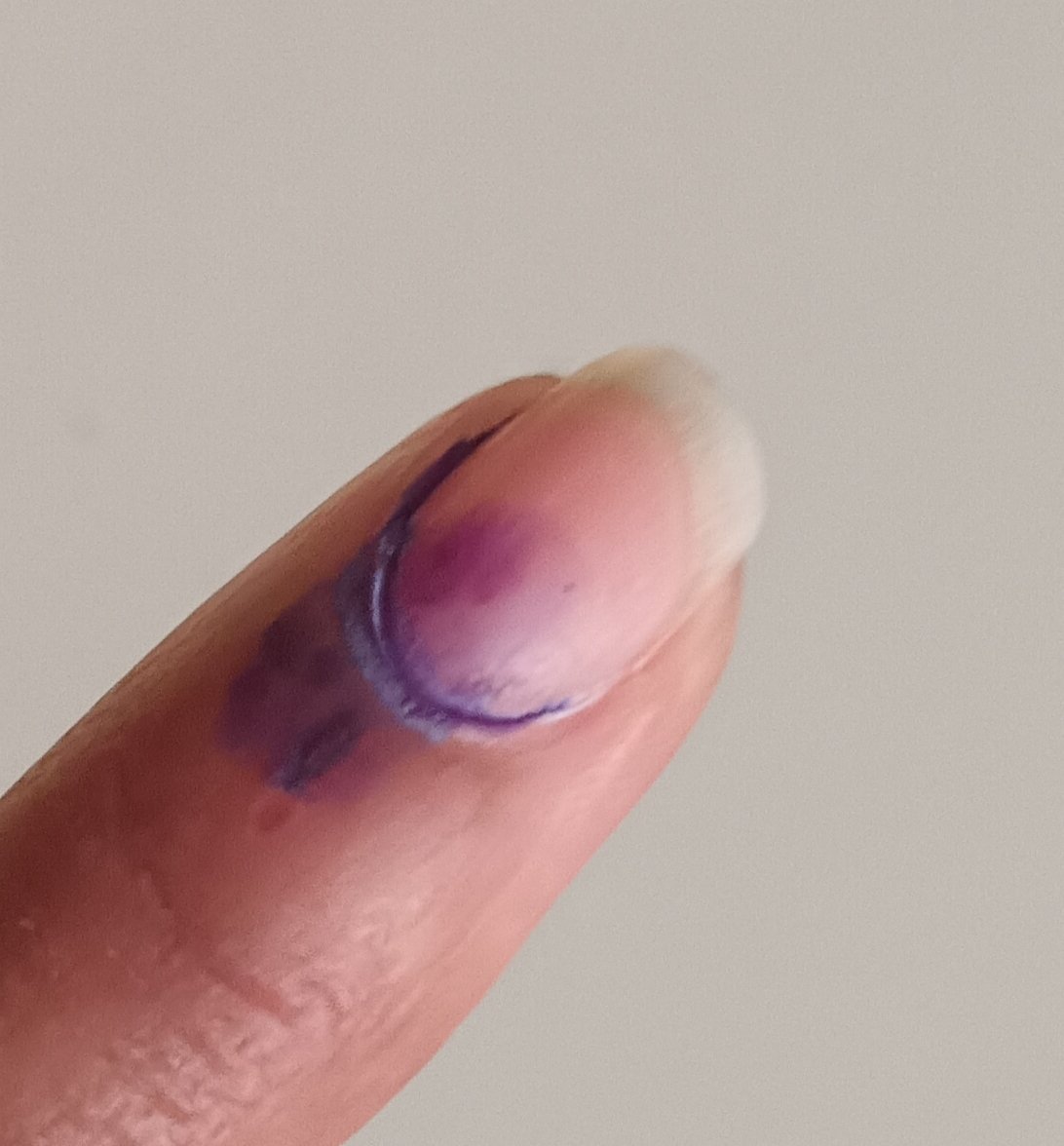 I utilised section 326.
did you?
#Vote
#LokSabhaElection2024

The year 2024 is an election year across the
world. 
#electionYear
At least 64 countries, both developed and developing, accounting for 49% of world
population, will go to the polls.
#Elections2024