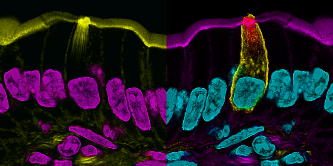 A pretty good tuft for #TuftTuesday

#microscopy #intestine #bioart #sciart #histoart #pathart