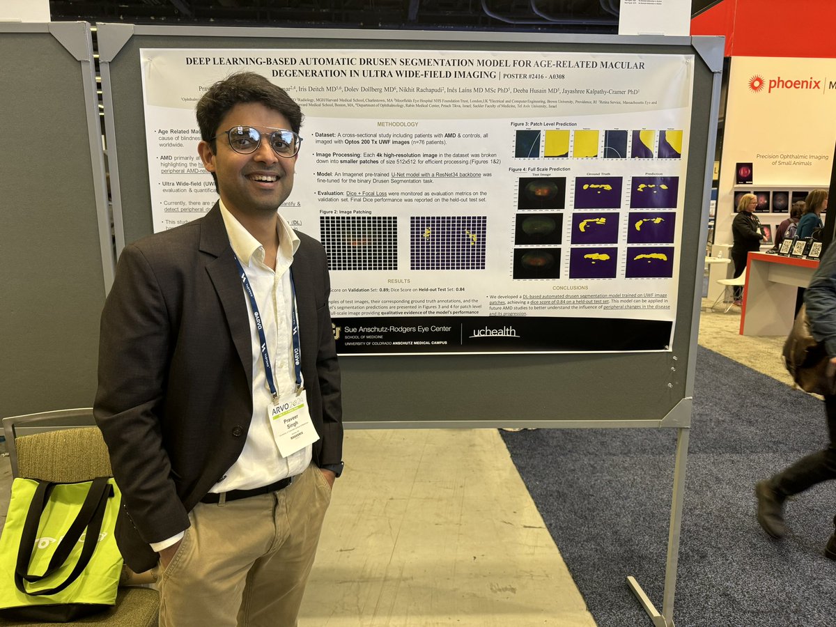 Captain @praveersingh90 presenting his work on automatic drusen segmentation for AMD with UWF imaging @CUEyeCenter @qtimlab