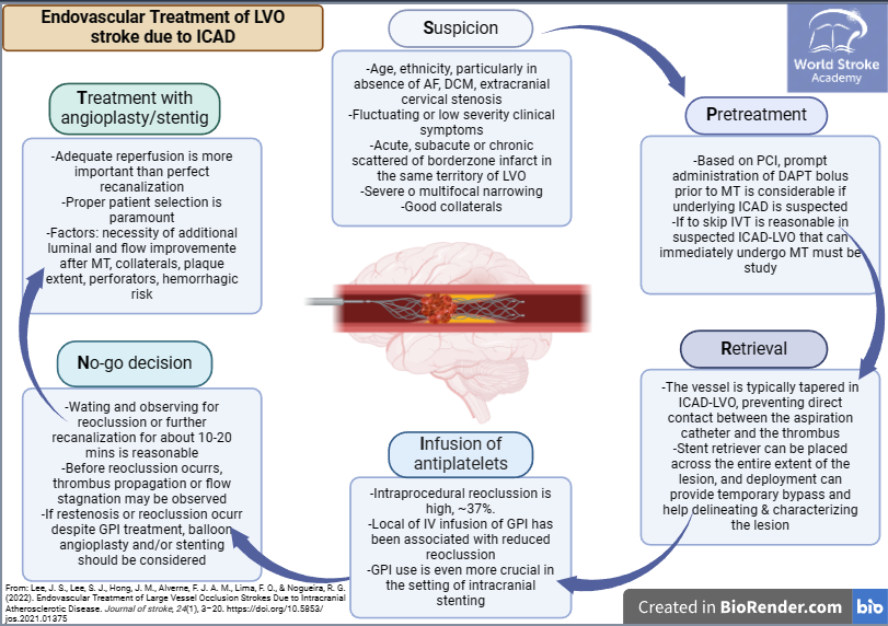 #Mondaytip 🧠Endovascular Management of LVO #stroke due to Intracranial Atherosclerotic Disease #ICAD The #SPRINT approach: Suspicion Pretreatment Retrieval Infusion of antiplatelets No-go decision Treatment with angioplasty/stenting From: j-stroke.org/journal/view.p… #OpenAccess