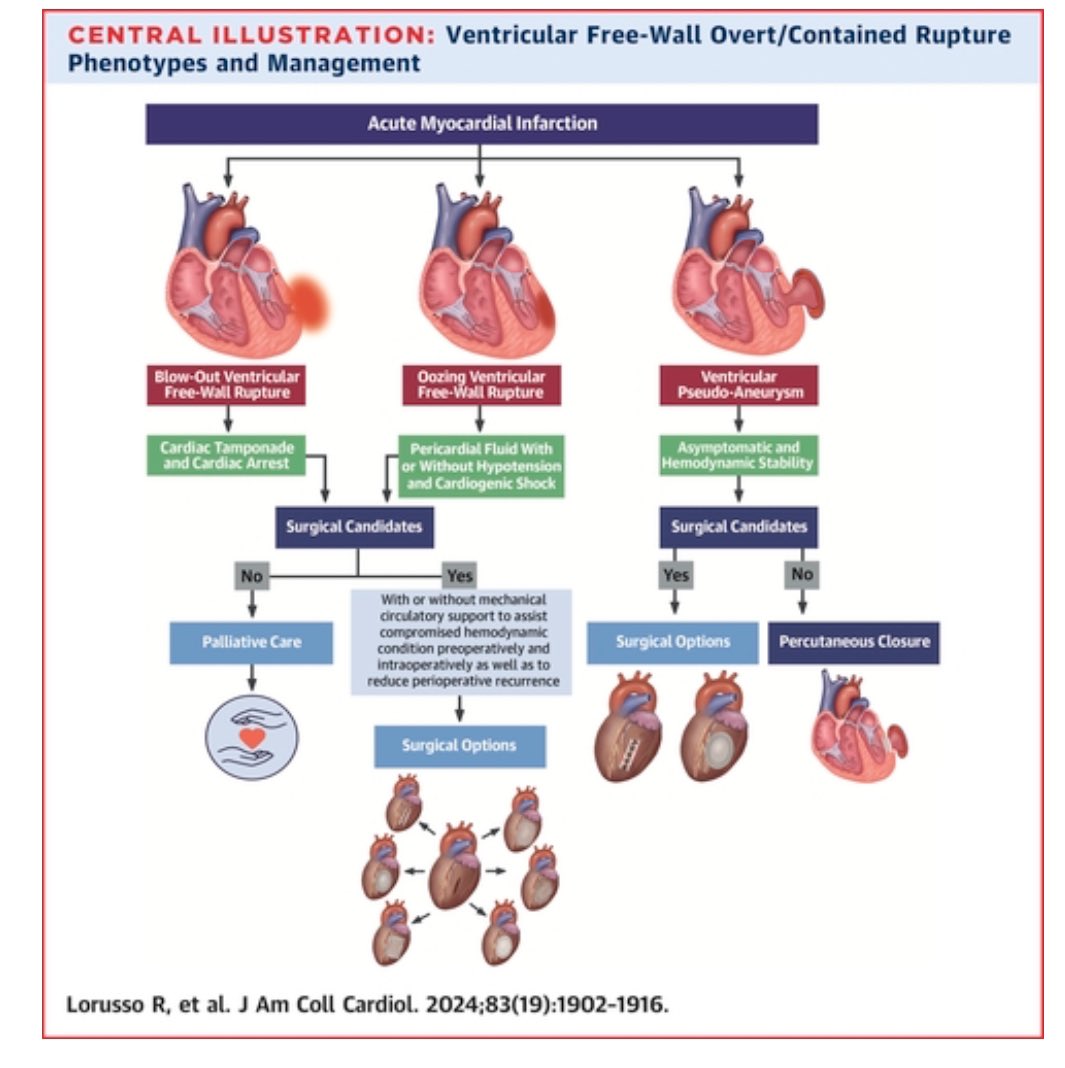 Was looking fwd to sharing two of our recent articles published today in <a href="/JACCJournals/">JACC Journals</a> on “Ventricular Septal Rupture jacc.org/doi/10.1016/j.… &amp; Ventricular PSA/Free Wall Rupture  jacc.org/doi/10.1016/j.… <a href="/ACCinTouch/">American College of Cardiology</a> <a href="/AnotherDrAxline/">Michael Axline, MD</a> <a href="/PU84/">David R. Axline, MD, FACC</a> <a href="/NCHRooneyHeart/">NCH Rooney Heart Institute</a> #AMI #shock