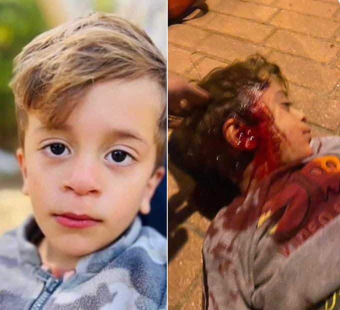Many months before Oct 7, Israelis shot 2 year old Palestinian Mohamad Tamimi in the head because he was related to activist Ahed Tamimi.

Never forget who started this.