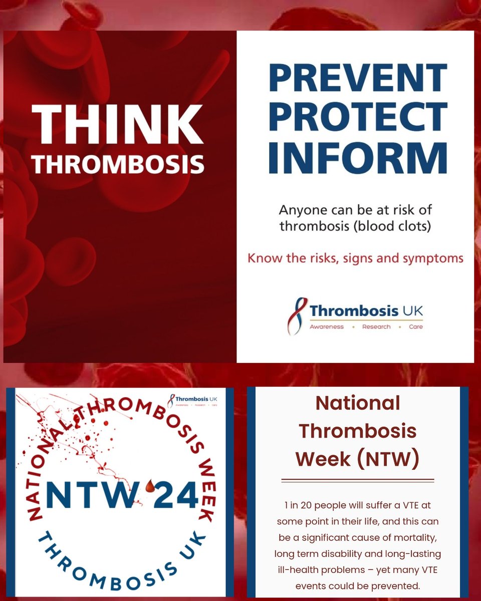 In celebration of National Thrombosis Week 2024 (NTW), our Anticoagulation team in Prince Phillip hospital <a href="/HywelDdaHB/">Hywel Dda UHB</a>  are aiming to increase awareness, extend education and improve understanding of thrombosis #NTW24 #VTEawarness #thrombosisweek  #KnowThrombosis #stoptheclot