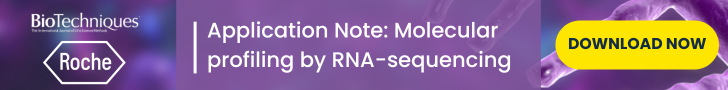 Don't miss this comprehensive Application Note from @Roche on high-resolution RNA analysis using RNA-seq. Read now to learn more about the leading library preparation kits for tumor profiling. Elevate your research today >>> hubs.ly/Q02v8DJN0