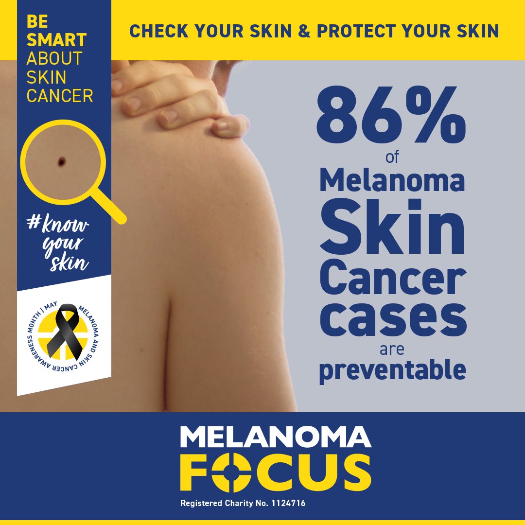 This #MelanomaAwarenessMonth @focusonmelanoma are urging you to #KnowYourSkin: ✔️ Check your skin and contact your GP if you notice new or changing moles or lesions ✔️ Protect your skin from the sun with SPF30+ sunscreen Find out more: orlo.uk/vU3XQ