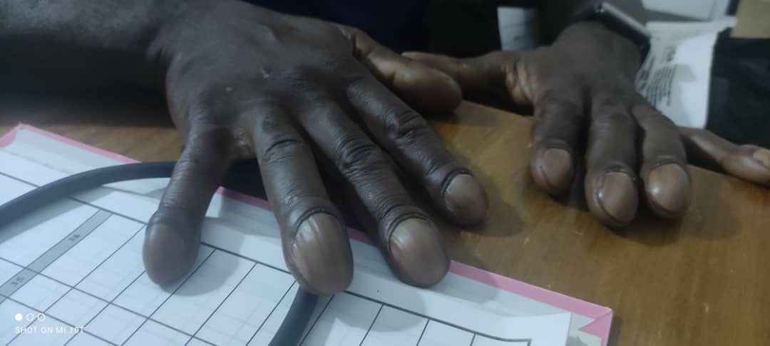 Bonjour à tous! Unpeu de Médecine ce Mardi! 

Savez-vous ce que c’est? Et ce que ça signifie ?