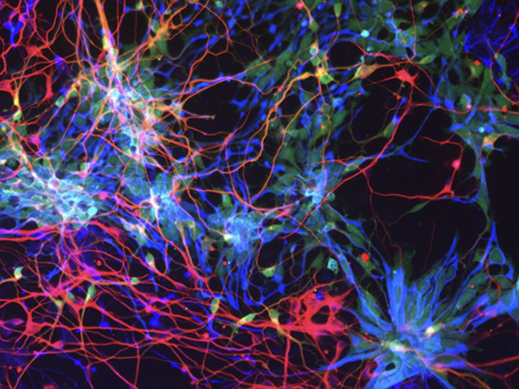 🧠 The teams of @MancusoRenzo (@CMN_VIB) & @DeStrooperLab (@CBD_VIB), with partners from @JNJInnovMedBE show how antisense nucleotides can target microglia in Alzheimer's disease! 👇 vibbio.tech/3JRHuGu