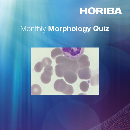Cell quiz⌛ What Red Cell feature is shown?  Share your guesses in the comments and stay tuned for the answer reveal next week! 

🔬 QSP Newsletter Issue 46: bit.ly/4b1lNQ6

#CellMorphology #MedicalLab #ClinicalLab #Hematology
