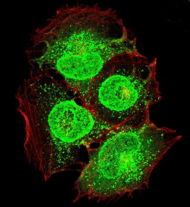 #IBSevents: Friday 24/05 at 11am, seminar by Dr Mustapha Si-Tahar (Director of the Research Center for Respiratory Diseases, Inserm U1100, Faculty of Medicine, Tours), entitled 'Metabolic control of virus-induced lung inflammation': urlz.fr/qA8c #lunginflammation