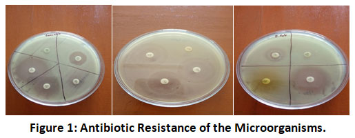 bit.ly/3sdi4vt - Read the Article here
Raw Milk in Noakhlai, Bangladesh: Quality Assessment and Antibiotic Resistance of Identified Microorganisms
#AntibioticResistance #MicrobiologicalQuality #Microorganisms #RawMilk #Nutrition #FoodSciences #foodprocessing