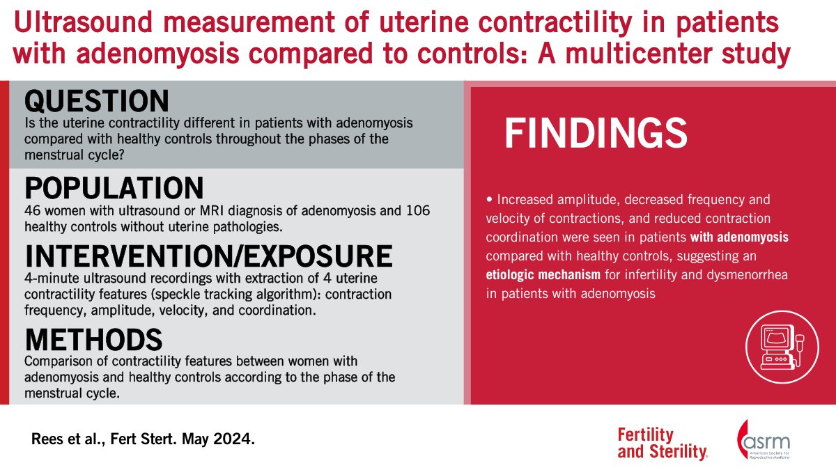 Quantitative ultrasound measurement of uterine contractility in adenomyotic versus normal uteri: A multicenter prospective study Full text 👇 doi.org/10.1016/j.fert…