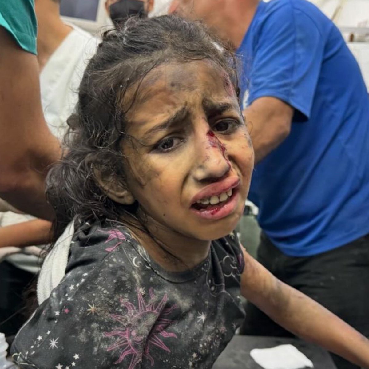 Çocuğumun bir damla gözyaşı için dünyayıyı yıkarım diyenler.
Gazze de gözyaşı akacak çocuk bırakmadılar, acıları büyüdükçe gözyaşlarını  içine akıtan çocukları görüyor musunuz.. 

#Hamas #Netanyahu
#Rafah #öğretmen
#Israel #GazaGenocide