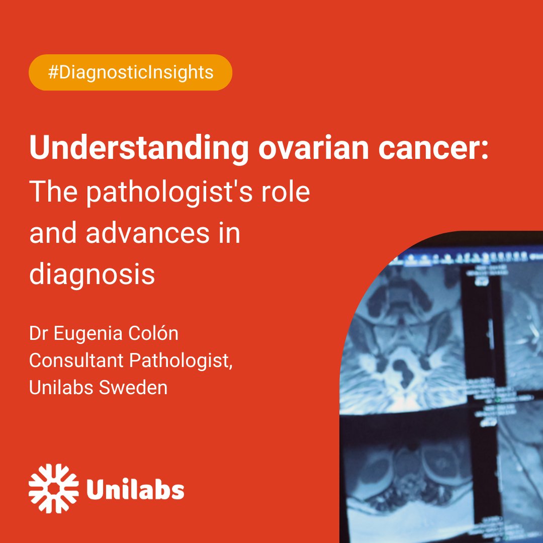 On Ovarian Cancer Day, explore how collaboration and molecular testing are transforming ovarian #cancer diagnosis, enabling earlier detection and bringing a new era of personalised medicine⤵️ unilabs.com/Understanding-… #Healthcare #Diagnostics