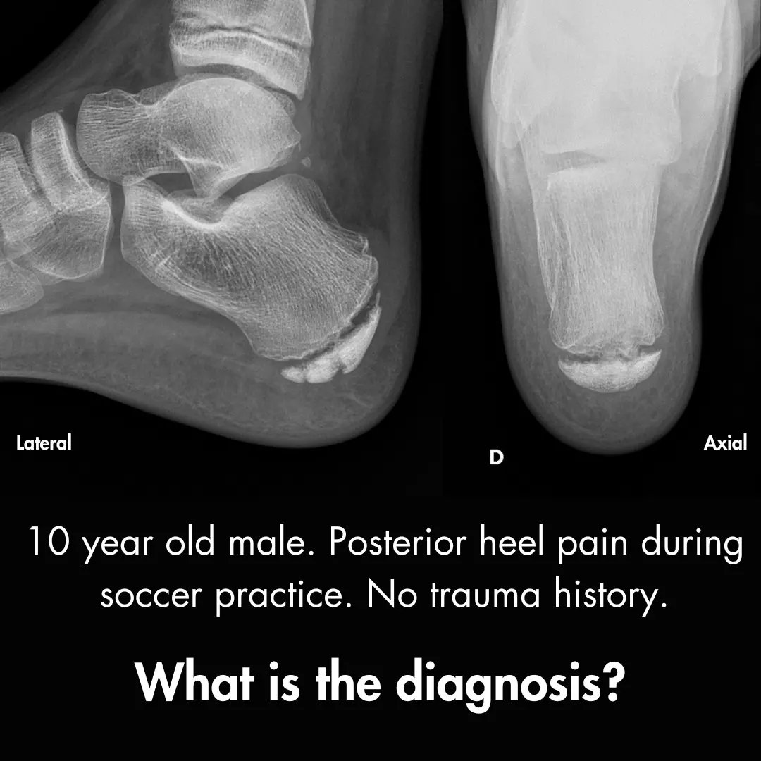 Orthopaedic Tutorials tweet media
