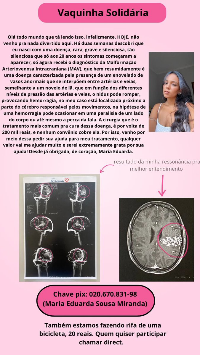 gahbriellll's tweet photo. oi, gente. tudo bem? hoje venho aqui por um motivo muito delicado. a maria eduarda, uma jovem de vinte anos, recebeu recentemente o diagnóstico de MAV -malformação arteriovenosa intracraniana-, desde então ela tem passado por uma série de exames e por momentos extremamente… https://t.co/GJ4RWHSIFF