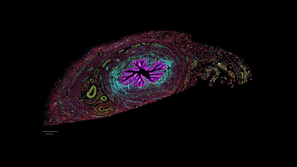 Please don't ovary-act when seeing this CODEX image of the isthmus, the part that connects the fallopian tube to the uterus that was generated by Dr. Kate O'Neill and Dr. Junhyong Kim @PennMedicine. Isthmus be the way of this egg-tra-ordinary organ.  #WomenInScience