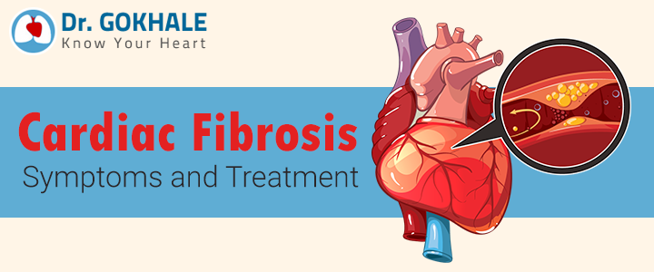 Cardiac Fibrosis Symptoms and Treatment.

#CardiacFibrosis refers to a state where there is an overabundance of collagen in the #Heart muscle, resulting in the hardening of heart tissue and diminished operation. 

Know more at: drgokhale.com/blog/cardiac-f…